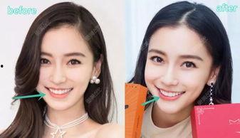 地方明星网红整形医院,美丽蜕变背后的秘密解析