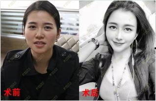 东北为什么明星网红多,地域文化魅力与时代机遇的完美融合”